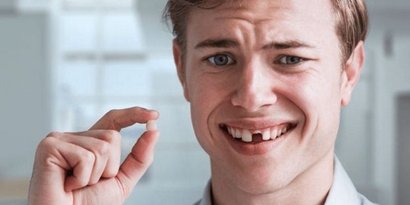 Trường hợp mơ thấy răng rụng phổ biến nhất